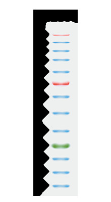11 밴드 9-180KDA는 고역 단백질 마커 2x250ul 3 색 25-300kDa를 청색화합니다